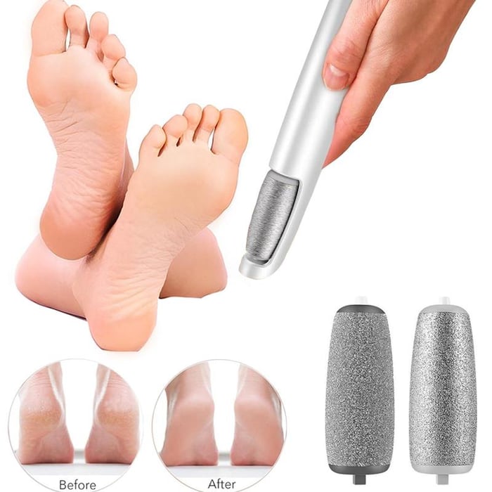 FootRenew™ - Verban Pijnlijke Eelt Met Professionele Kracht En Comfort