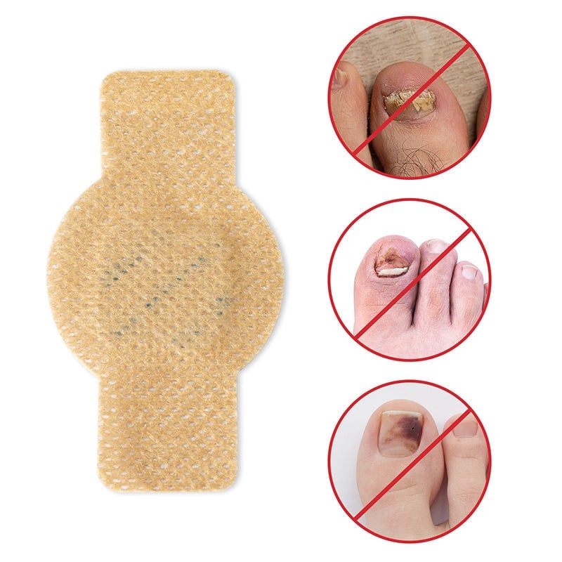 PureNail™ Herstel je Nagels Optimaal