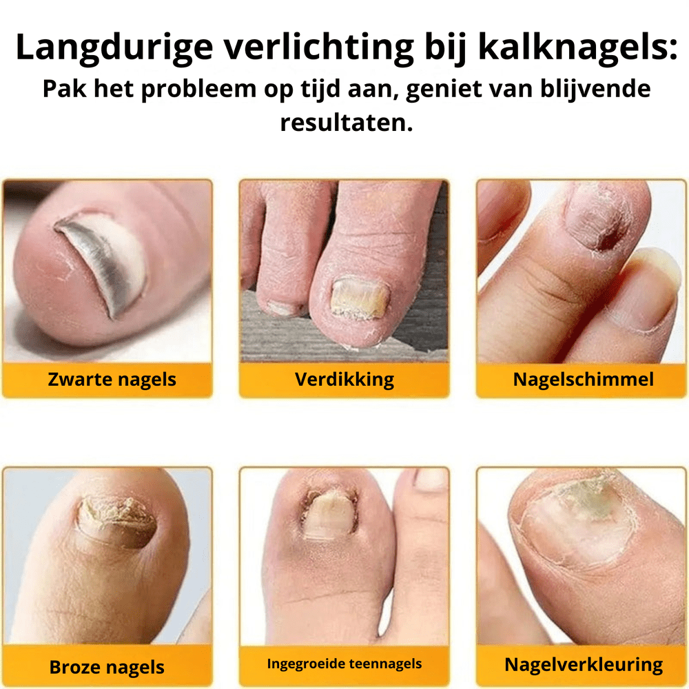 PureNail™ Herstel je Nagels Optimaal