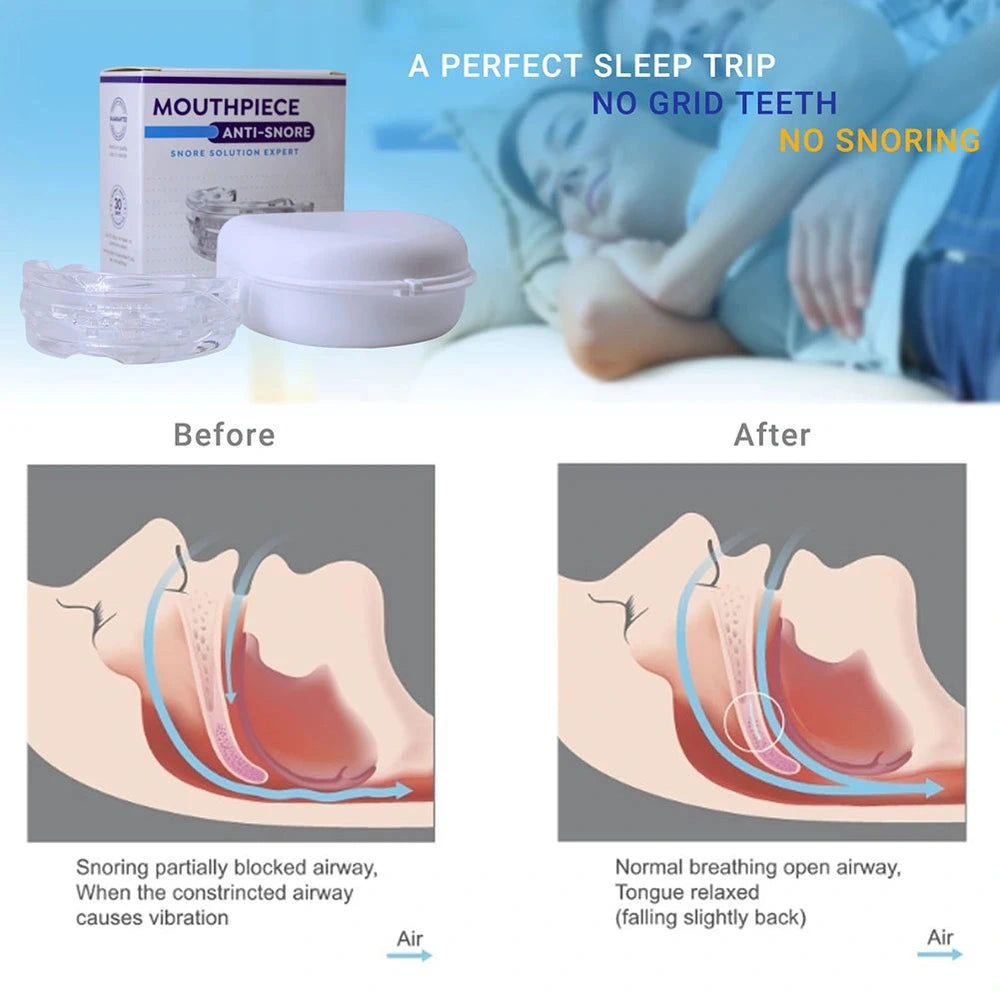 QuietSleep Mondstuk™ - Verander Luide Nachten In Heerlijke Stille Dromen