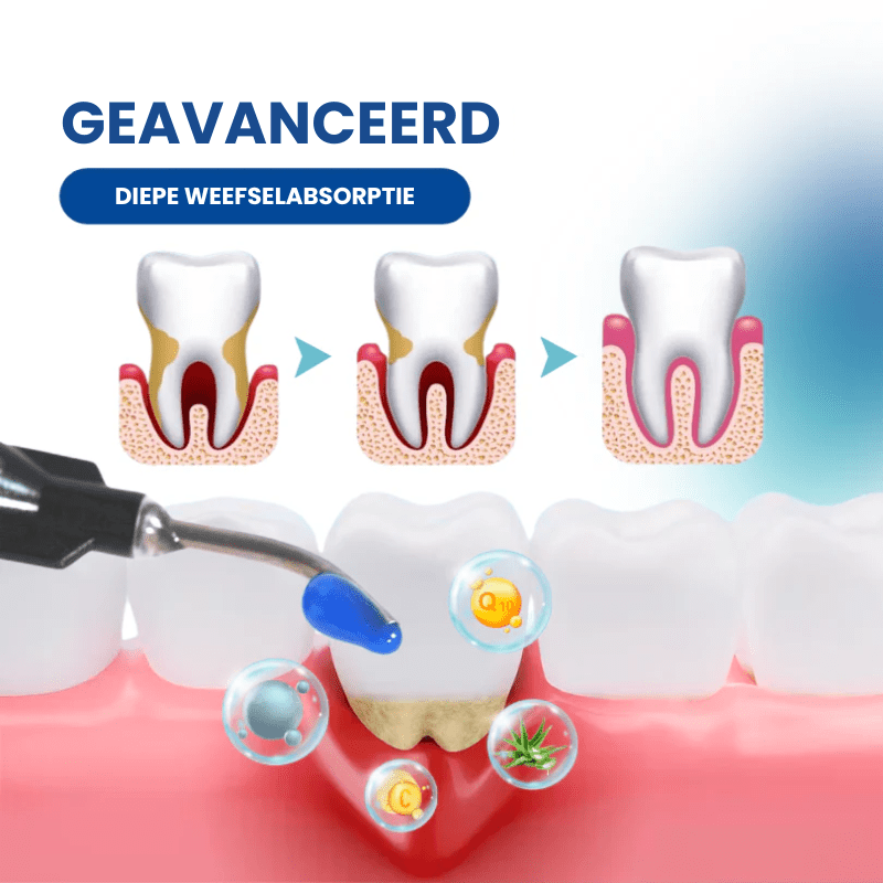 DENTAL GUARD™ - Herstel Jaren van Tandvleesschade Natuurlijk