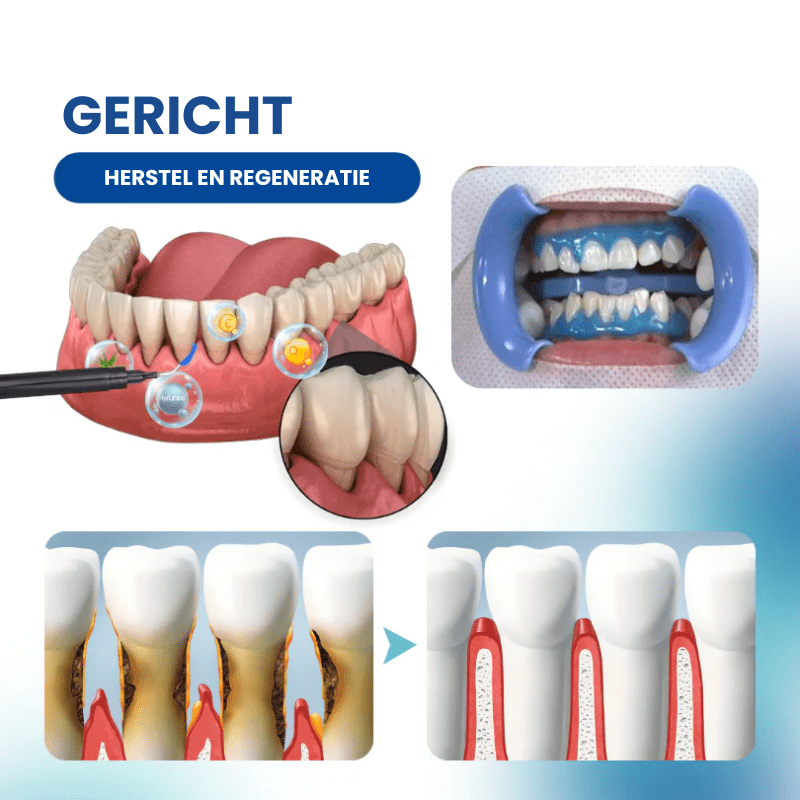 DENTAL GUARD™ - Herstel Jaren van Tandvleesschade Natuurlijk