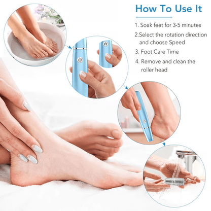 FootRenew™ - Verban Pijnlijke Eelt Met Professionele Kracht En Comfort