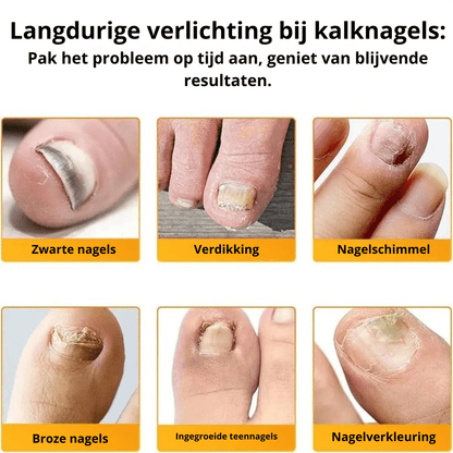 PureNail™ Herstel je Nagels Optimaal