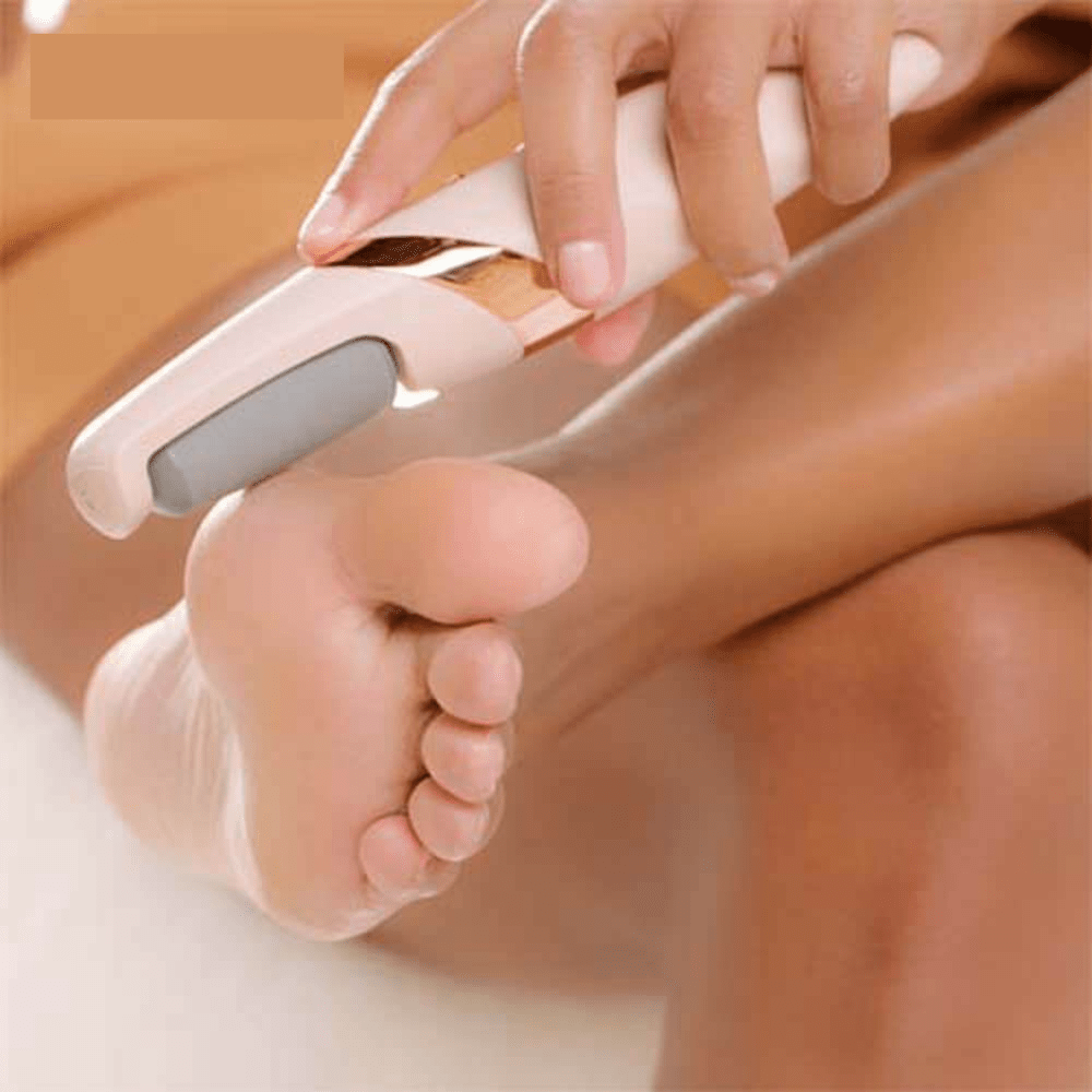 Callus Remover™ - Moeiteloze pedicure perfectie voor zachte voeten!