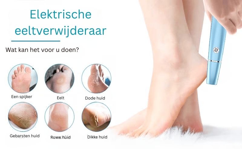 FootRenew™ - Verban Pijnlijke Eelt Met Professionele Kracht En Comfort