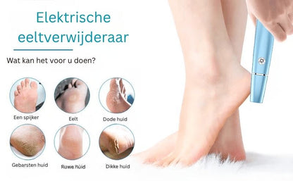 FootRenew™ - Verban Pijnlijke Eelt Met Professionele Kracht En Comfort