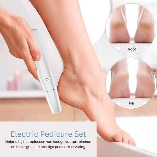 FootRenew™ - Verban Pijnlijke Eelt Met Professionele Kracht En Comfort