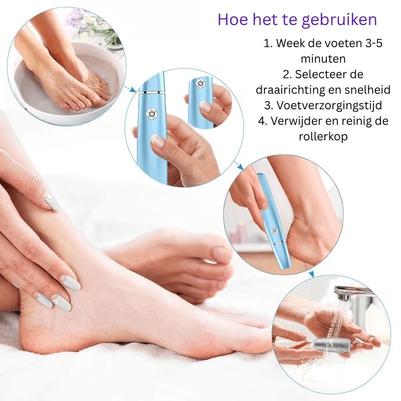 FootRenew™ - Verban Pijnlijke Eelt Met Professionele Kracht En Comfort