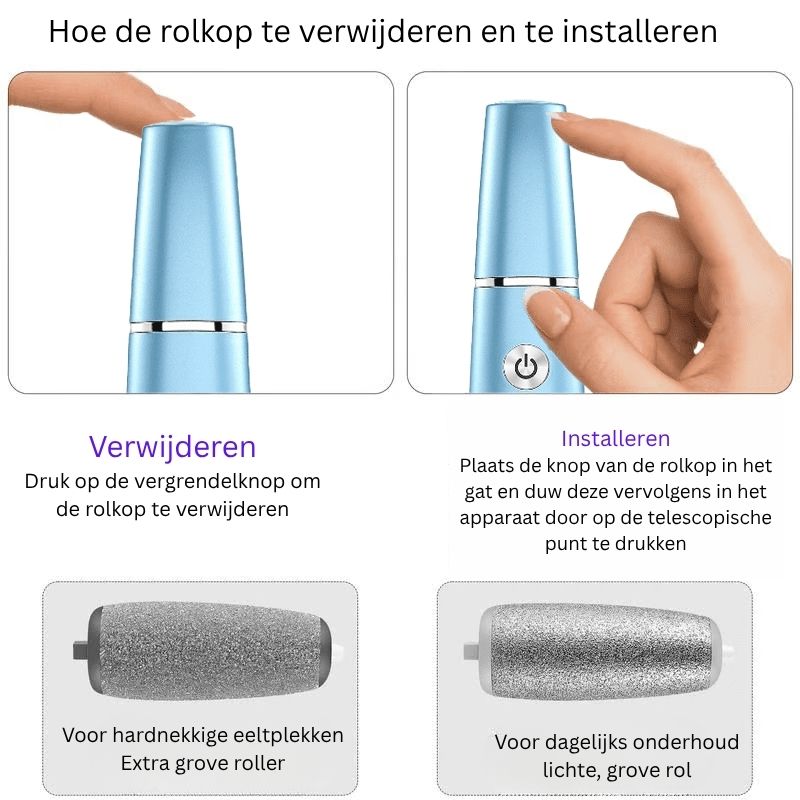 FootRenew™ - Verban Pijnlijke Eelt Met Professionele Kracht En Comfort