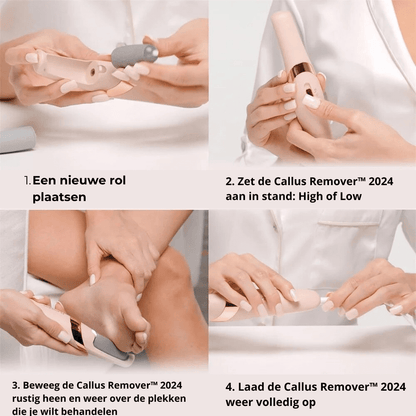 Callus Remover™ - Moeiteloze pedicure perfectie voor zachte voeten!