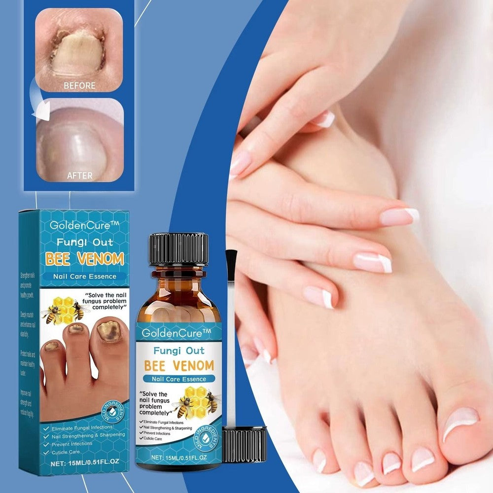 GoldenCure™- Herwin Je Zelfvertrouwen Met Natuurlijk Mooie, Gezonde Nagels