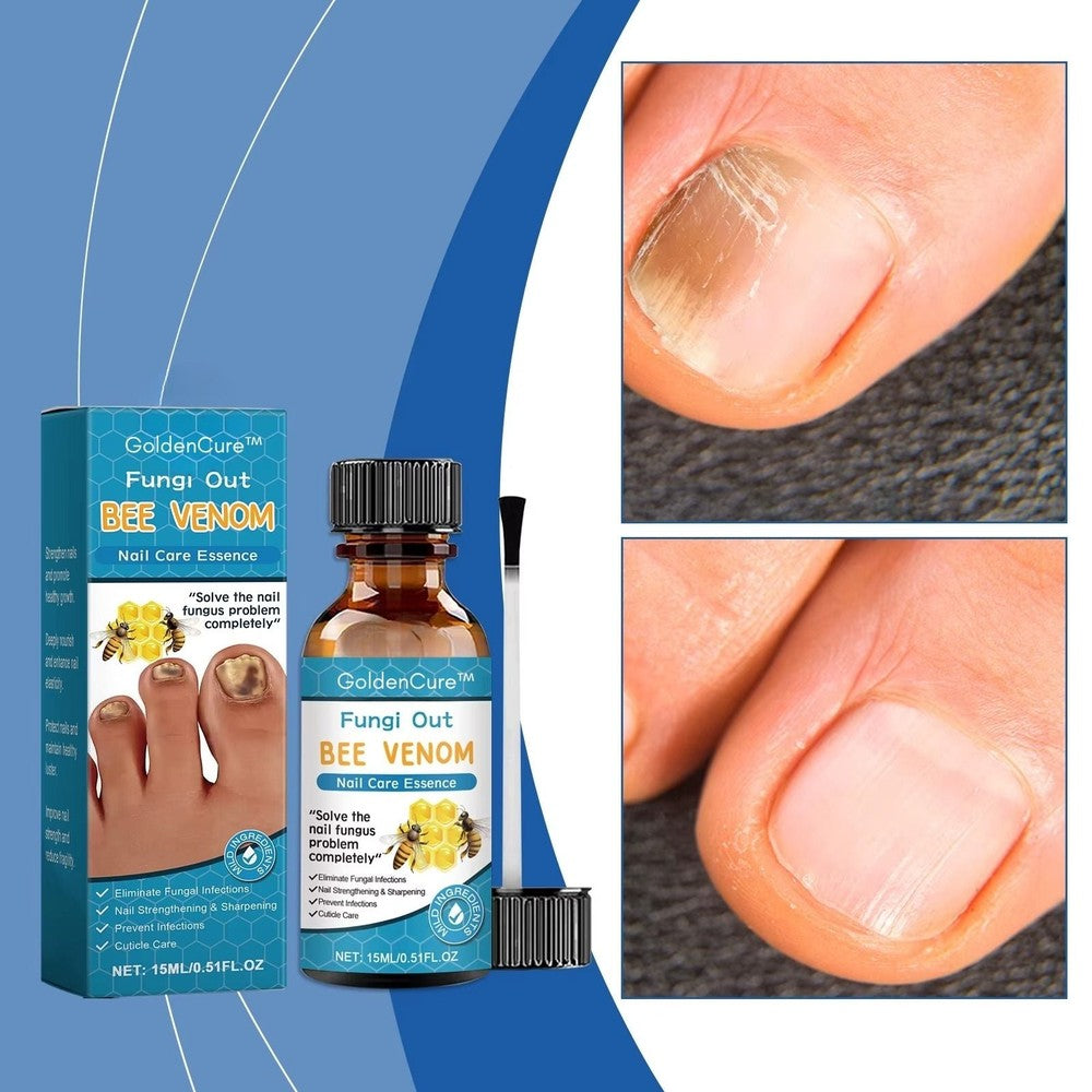 GoldenCure™- Herwin Je Zelfvertrouwen Met Natuurlijk Mooie, Gezonde Nagels